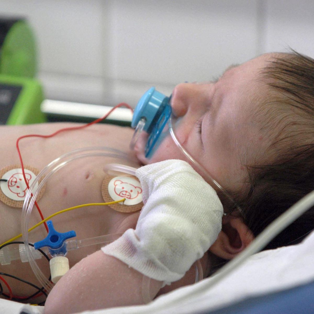 Bronchiolite Faire Des Bisous Aux Bebes Est Fortement Deconseille Cet Hiver Le Matin