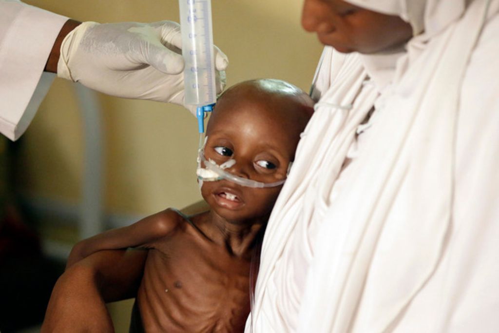 Nigeria La famine menace 200 enfants chaque jour Le Matin