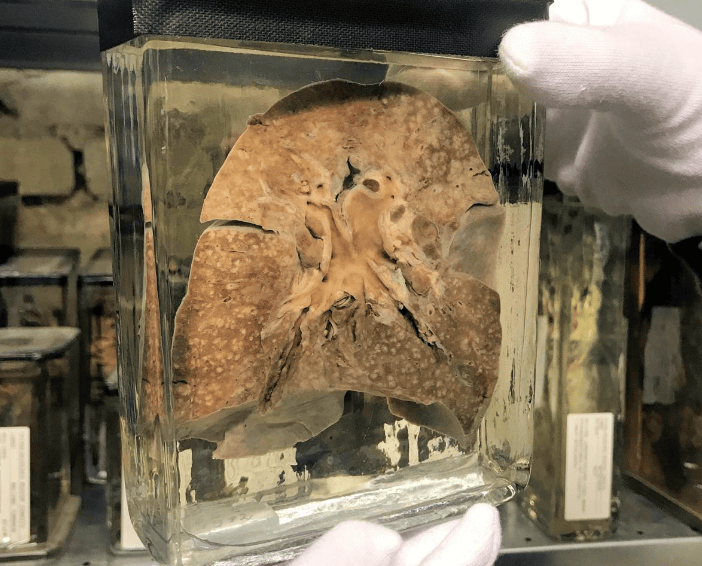 Volle Regale: Hunderte von Präparaten lagern in verschiedenen Räumen im Untergeschoss des Berliner Museums.