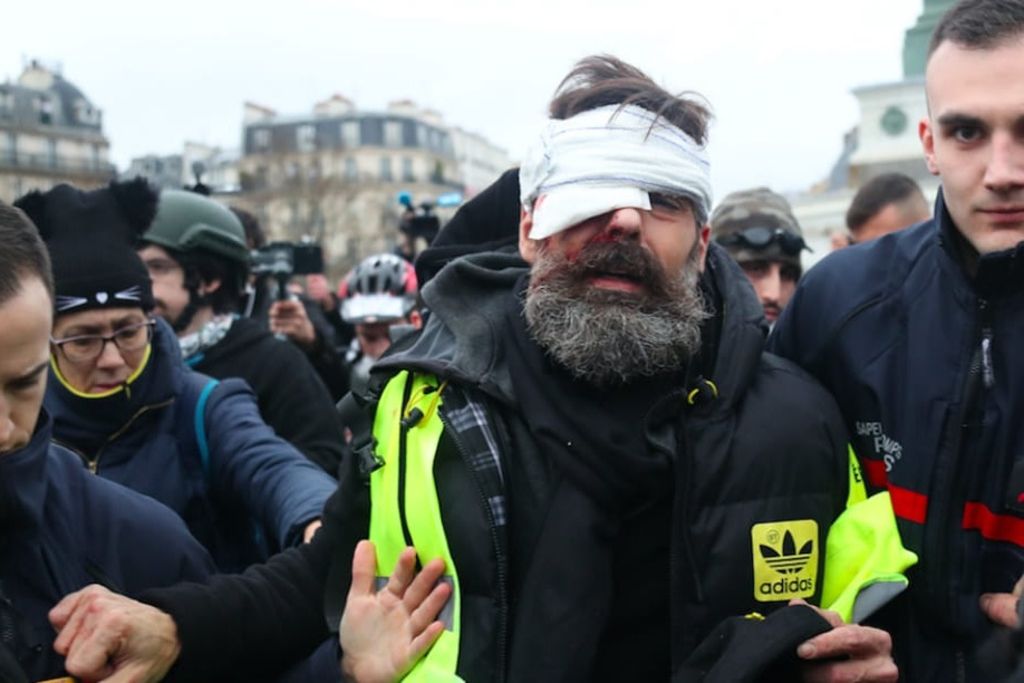 La France Va T Elle Reconfiner Manifs: La France va-t-elle interdire l'arme suisse qui crève les yeux