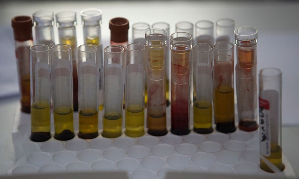 Der Krankheit auf der Spur