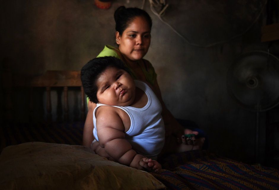 Mexique A 10 Mois Luisito Pese 28 Kilos Le Matin