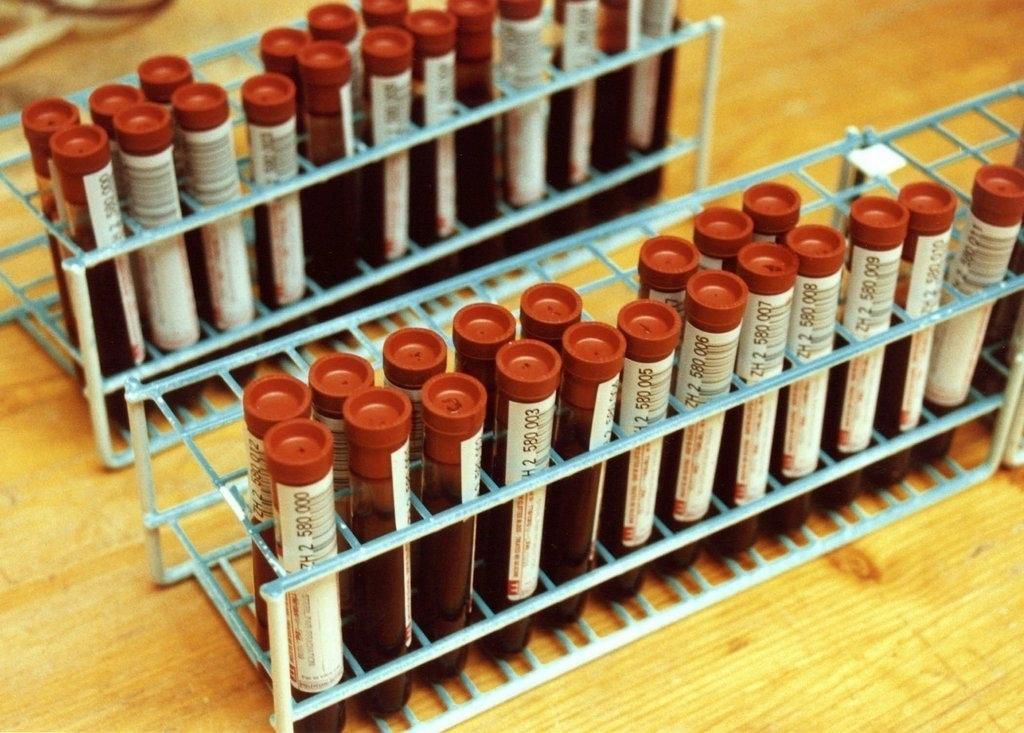 Probleme Beim Blutspenden Tattoo Stechen Oder Blut Spenden 20 Minuten