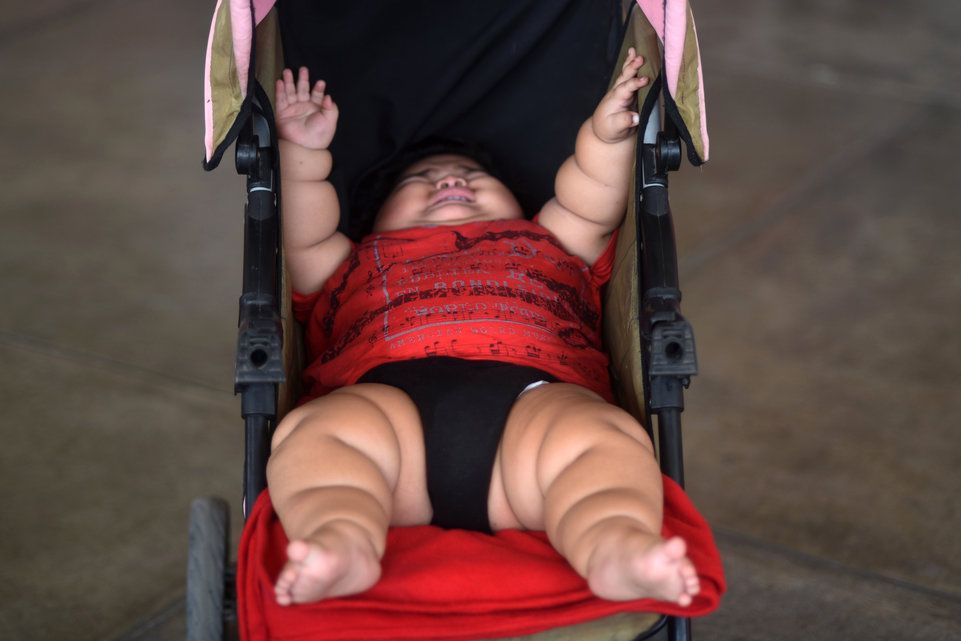Mexique A 10 Mois Luisito Pese 28 Kilos Le Matin