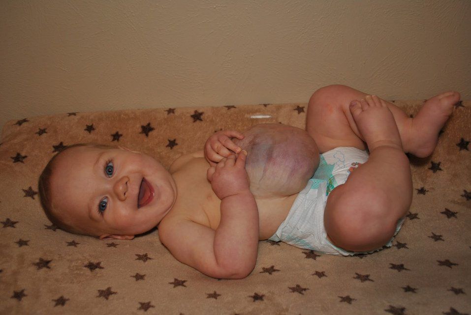 Houston Un Bebe Nait Avec Les Organes A L Exterieur De Son Corps Le Matin