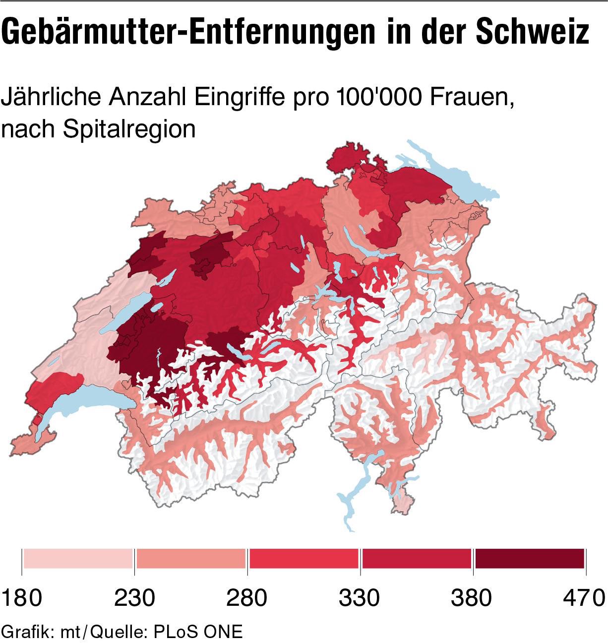Unerklarbare Operationen Bei Gebarmutter Entfernungen Gibt Es Grosse Unterschiede Der Bund
