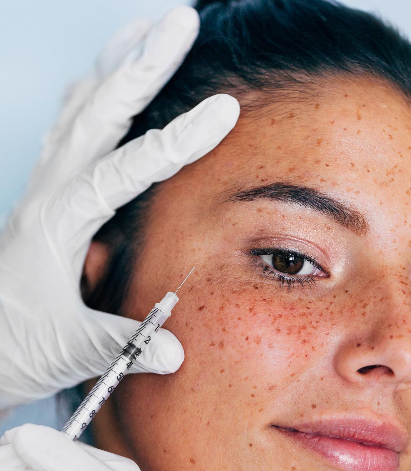 «Baby Botox» bei Millennials – Die Fältchen wegspritzen, wenn sie noch gar nicht sichtbar sind - Vimarsana News