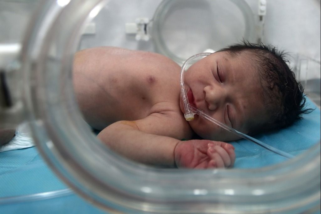 France Bebe Malforme Des Parents Portent Plainte 24 Heures