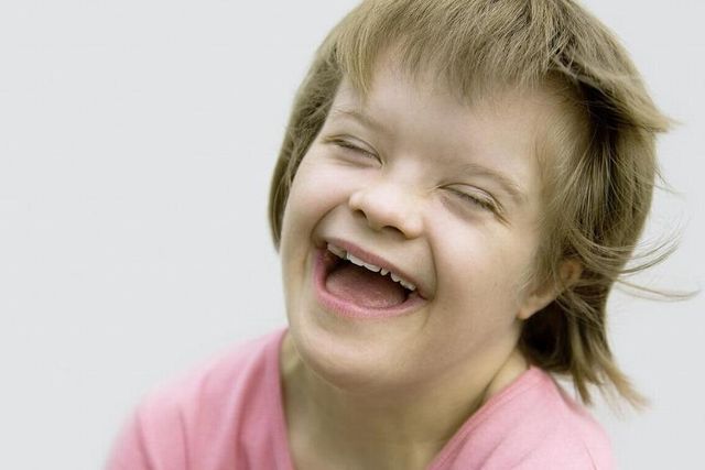 Handicap Le Nouveau Test Pour Detecter La Trisomie Fait Peur Le Matin