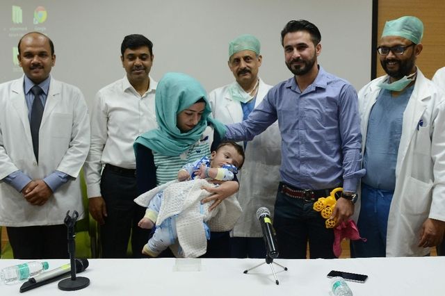 Inde Un Bebe A Huit Bras Et Jambes Opere Avec Succes 24 Heures