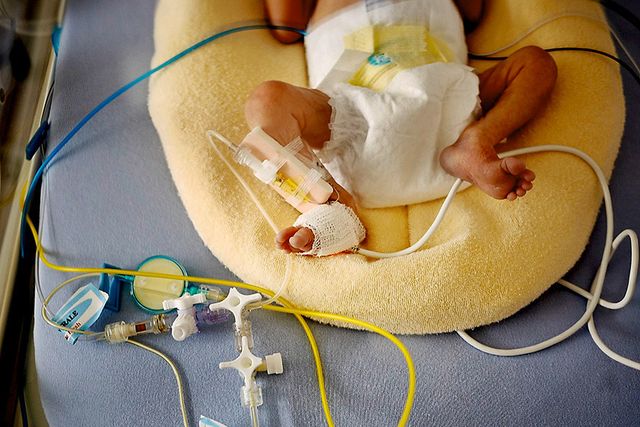 Le Bruit Perturbe Les Bebes Prematures 24 Heures