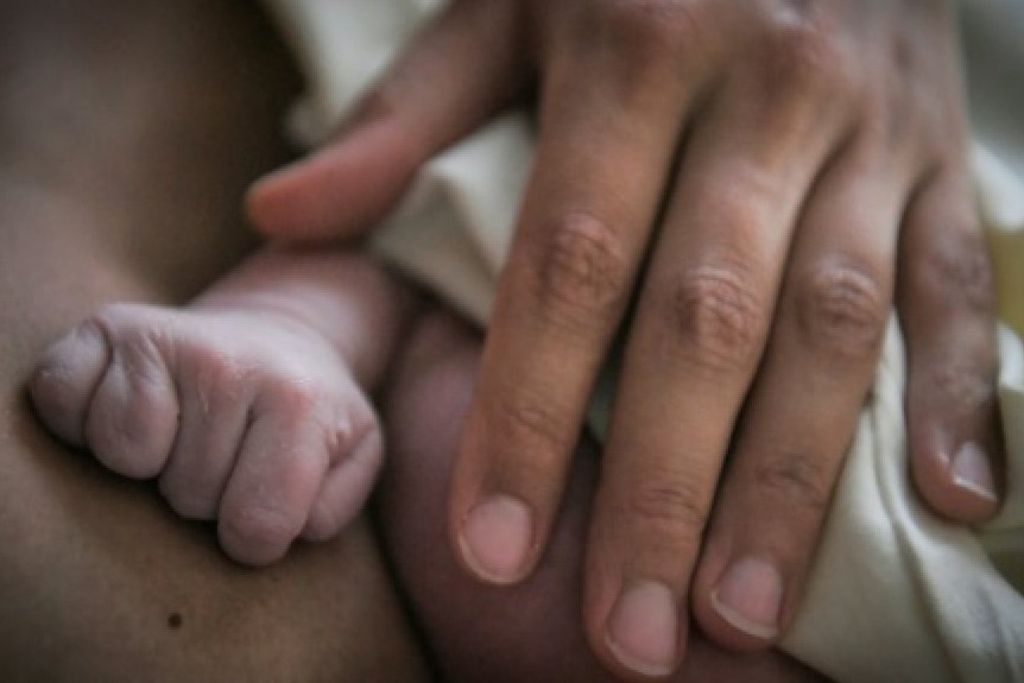 France Bebe Malforme Des Parents Portent Plainte 24 Heures