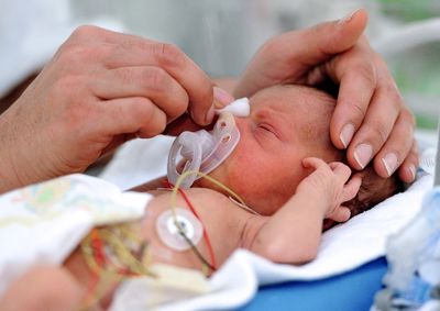 Sante Un Test Pour Deceler Les Bebes Prematures 24 Heures