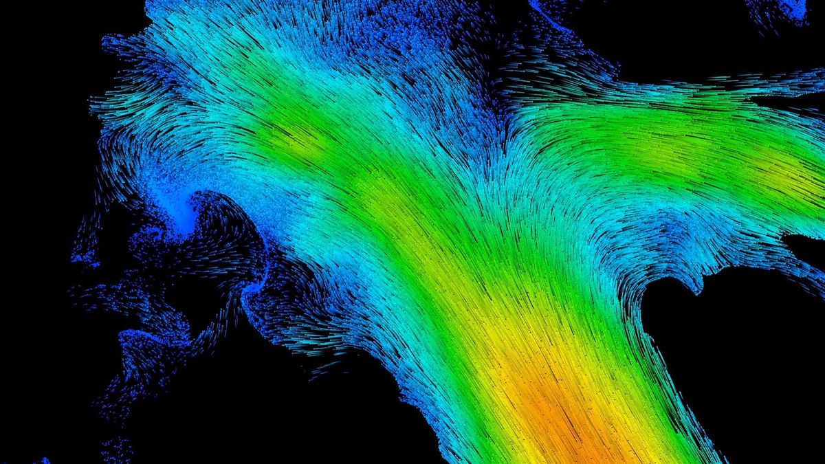 La microscopie par ultrasons permet notamment d’obtenir des images extrêmement fines de la vascularisation du cerveau et de détecter des anévrismes avec une précision inédite.