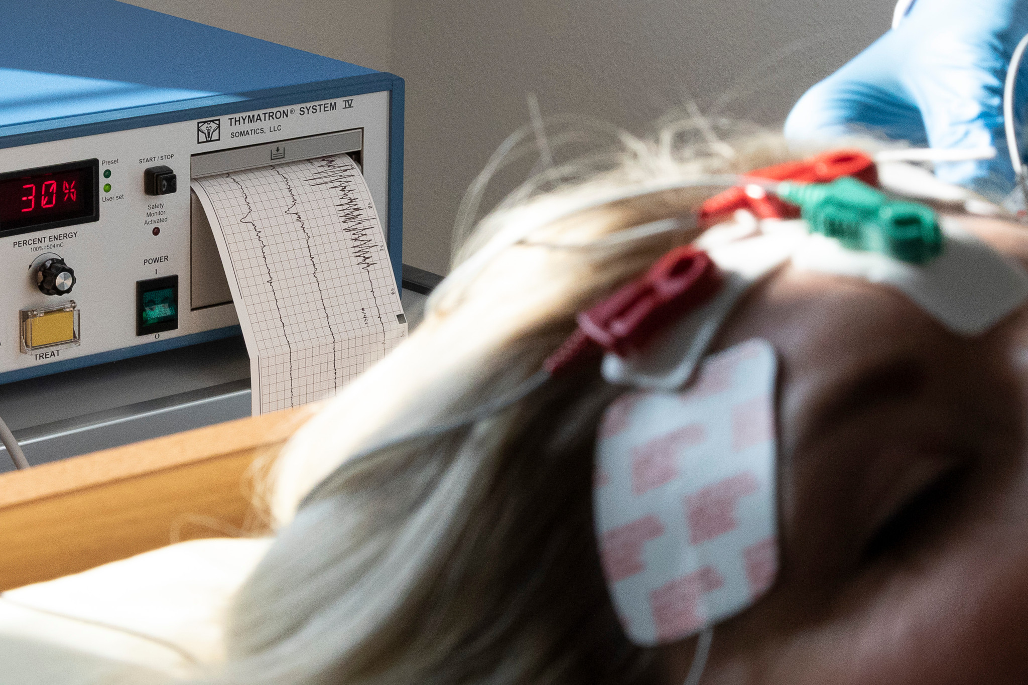 Trotz WHO-Warnung: Warum Psychiater die Therapie mit Stromschlägen vehement verteidigen