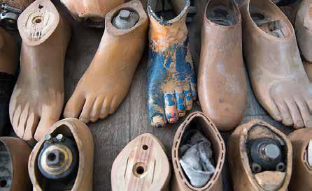 Des membres artificiels sont produits dans un centre en Bosnie-Herzégovine.