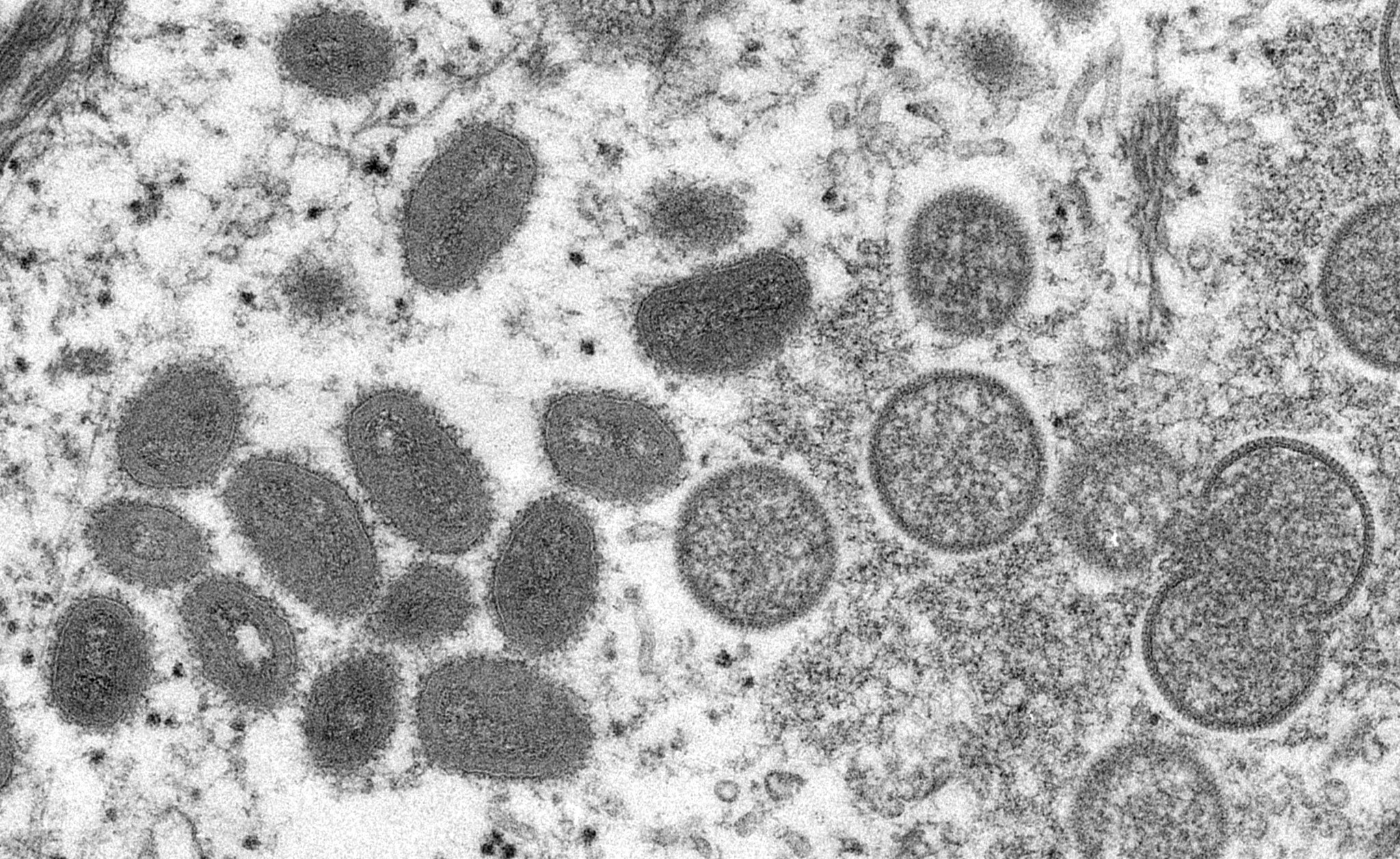La variole du singe a été découverte à la fin des années 50. 