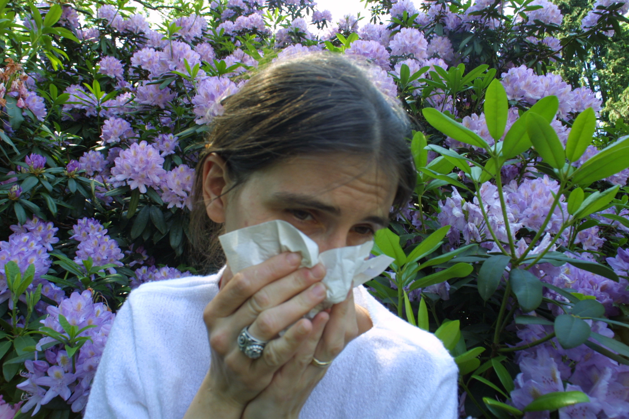 Pollen la saison des allergies débute en Suisse — free download