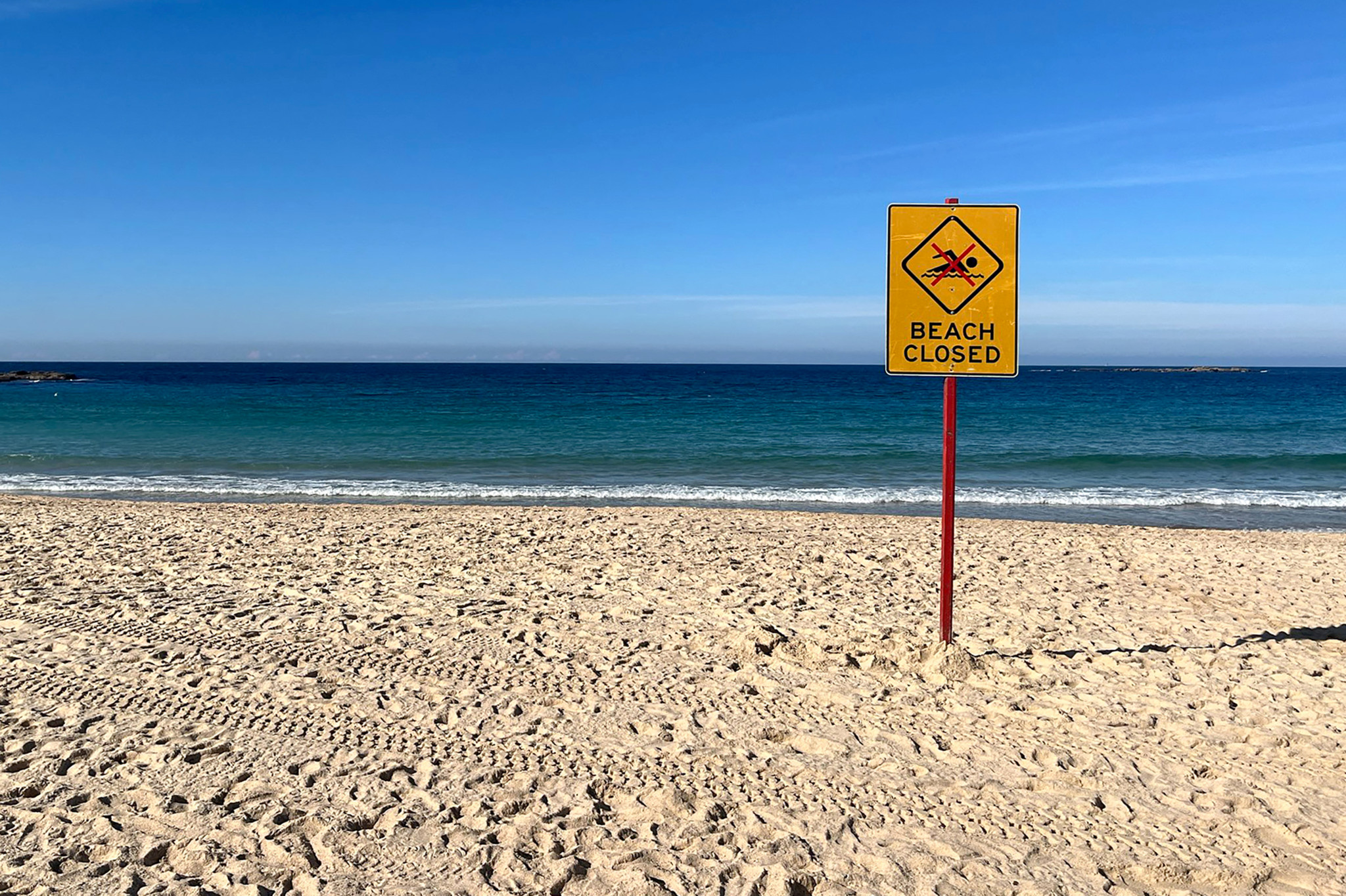 Attaque en Australie: Une nageuse grièvement blessée par un requin sur une plage de Sydney