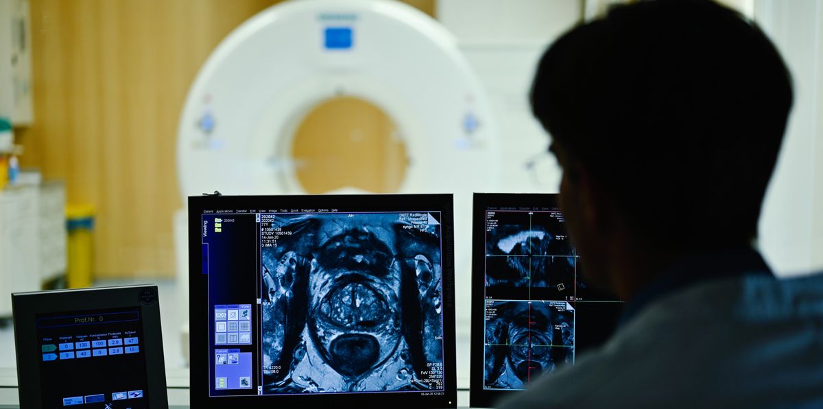 ARCHIV - 16.01.2020, Baden-Württemberg, Heidelberg: Ein Mitarbeiter betrachtet in einem Kontrollraum des Deutschen Krebsforschungszentrum (DKFZ) auf einem Monitor das Querschnittsbild einer Prostata. Durch die Corona-Pandemie sind nach Angaben der Techniker Krankenkasse (TK) in Bayern weniger Männer zur Krebsvorsorge gegangen. (zu dpa "TK: Bayerische Männer weniger bei Krebsvorsorge während Corona") Foto: Uwe Anspach/dpa +++ dpa-Bildfunk +++ (KEYSTONE/DPA/Uwe Anspach)