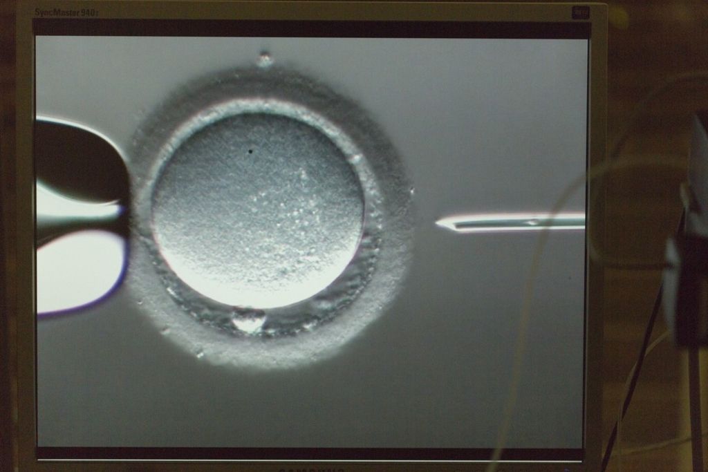 «L'une des pires tragédies de centre de fertilité»