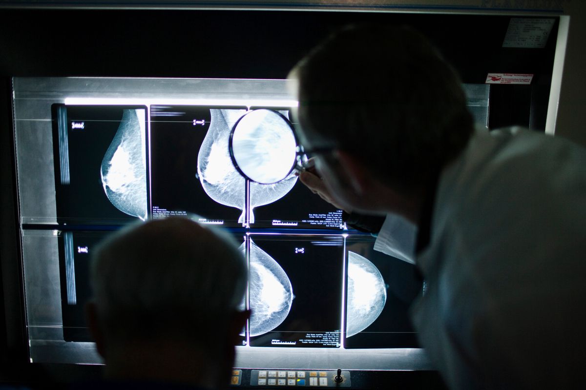 Two radiologists look at x-rays of a woman's breast at the Clinic Engeried in Bern, Switzerland, pictured on December 8, 2009. Mammography is a method for early detection of breast cancer (breast carcinoma). (KEYSTONE/Gaetan Bally)
Zwei Radiologen betrachten am 8. Dezember 2009 in der Klinik Engeried in Bern Roentgenbilder einer weiblichen Brust. Die Mammografie ist eine Methode zur Frueherkennung von Brustkrebs (Mammakarzinom). (KEYSTONE/Gaetan Bally)