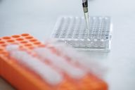 FuW-Einschätzung zum zusätzlichen EU-Patent für Evenamide: Newrons Hoffnungsträger ist in der EU nun deutlich länger patentgeschützt