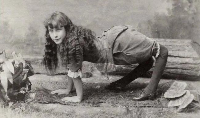 Ella Harper war durch einen Geburtsdefekt namens Genu recurvatum in der Lage, ihre Knie nach vorne durchbiegen.