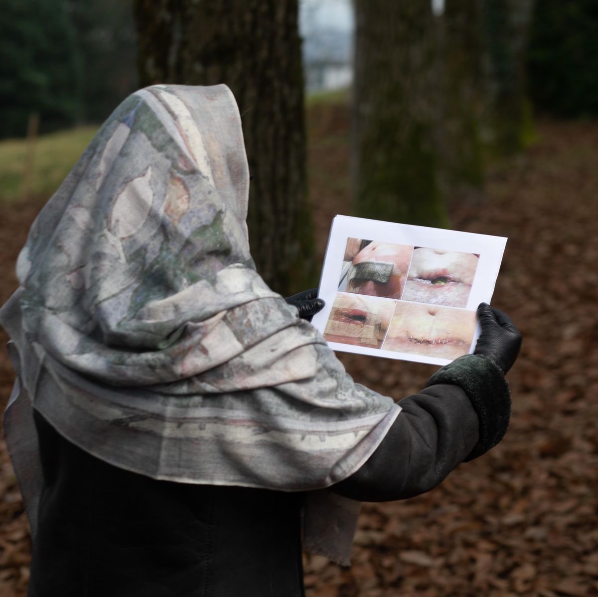 Wenn der Schönheitschirurg pfuscht

Zürich, 13.11.2021