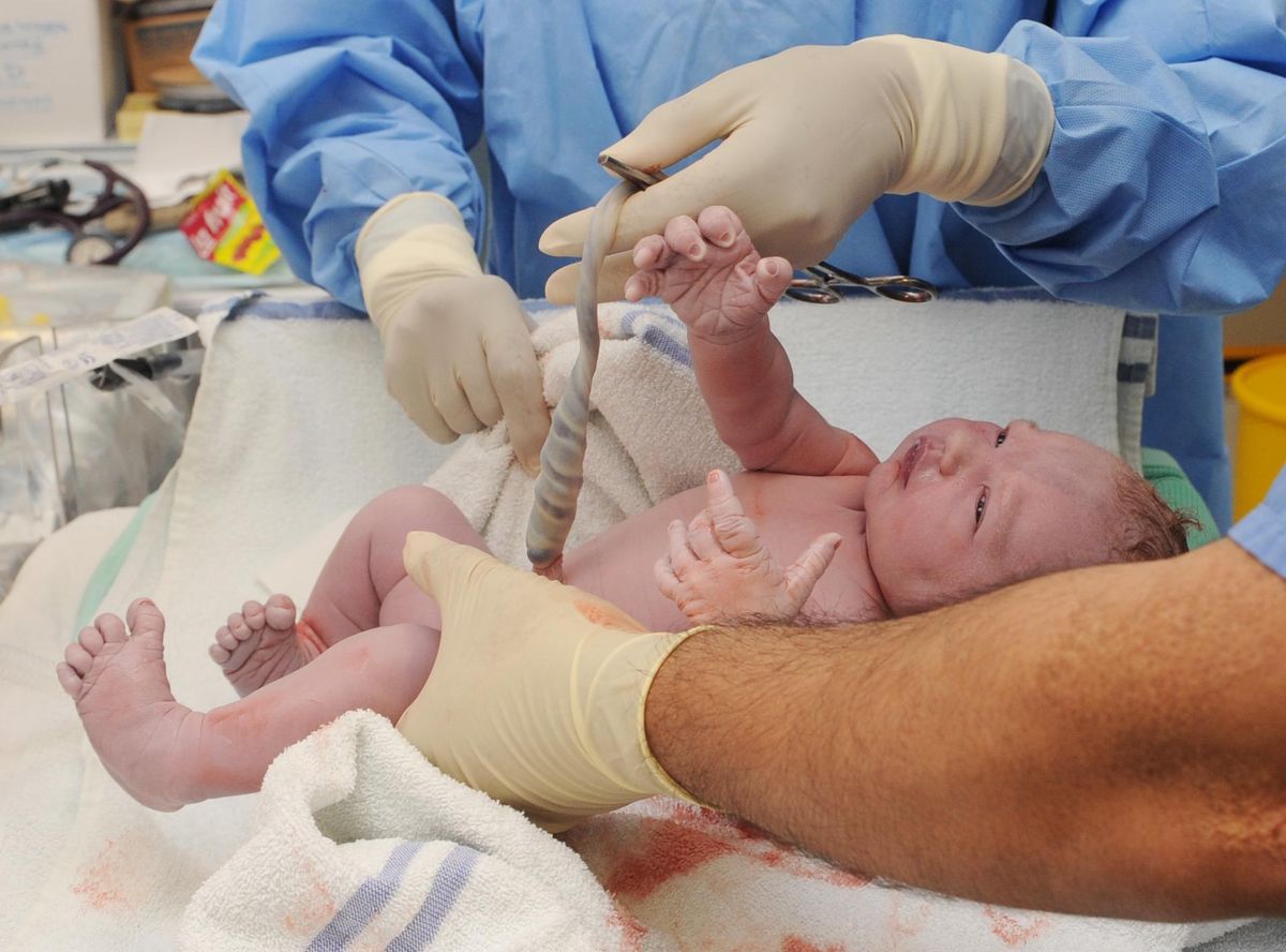 Professionnels de la santé préparant à couper le cordon ombilical d’un nouveau-né à Londres.