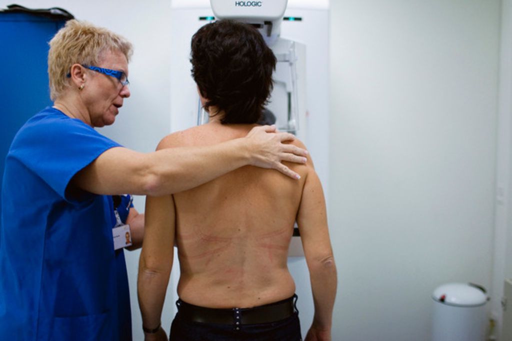 Cancer du sein: vers un test sanguin pour traquer les rechutes