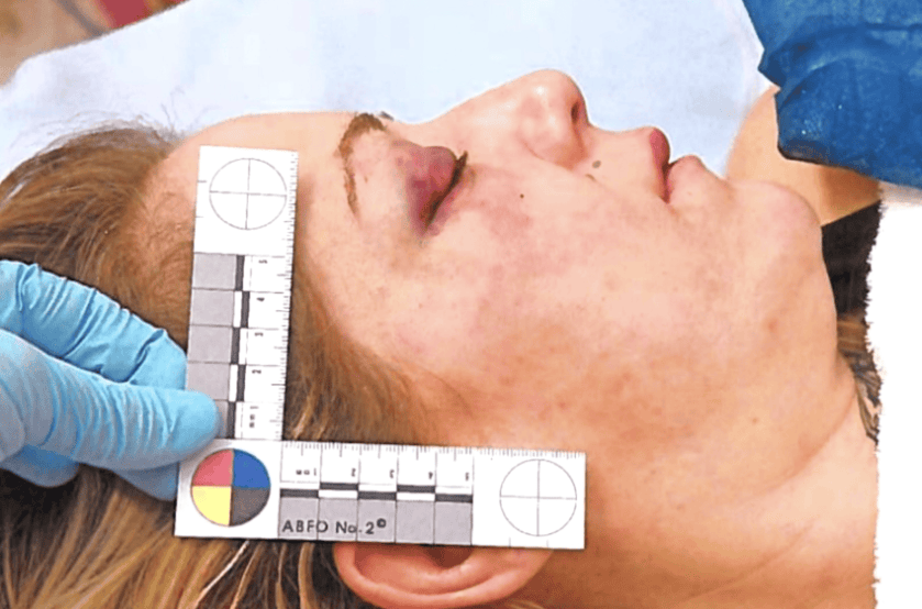 Schaffhauser Regierung will Prügelattacke untersuchen lassen