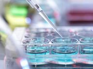 Jahreszahlen: Addex schreibt 2025 rote Zahlen