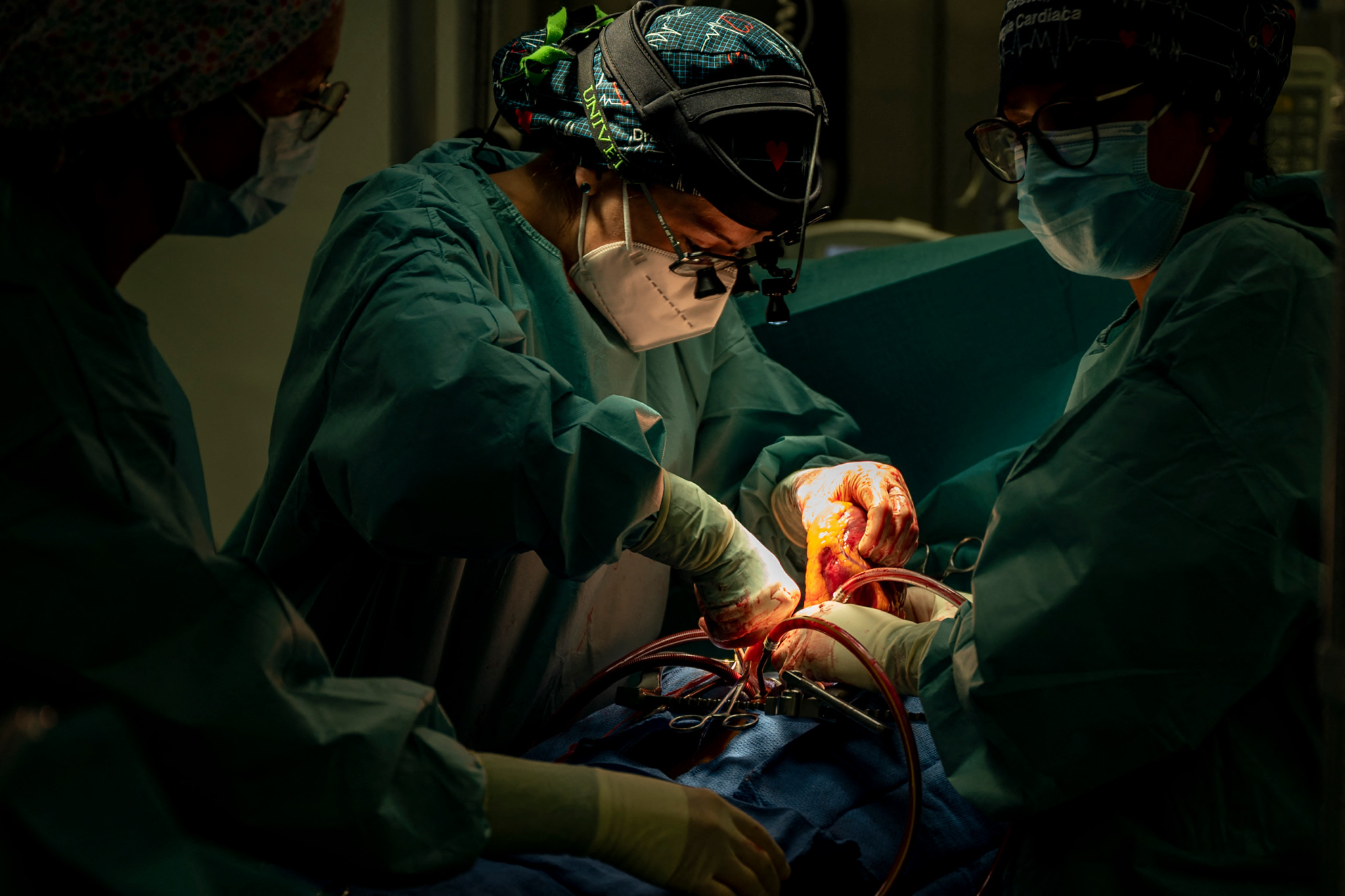 Neue Methode der Organtransplantation: Schweizer Mediziner