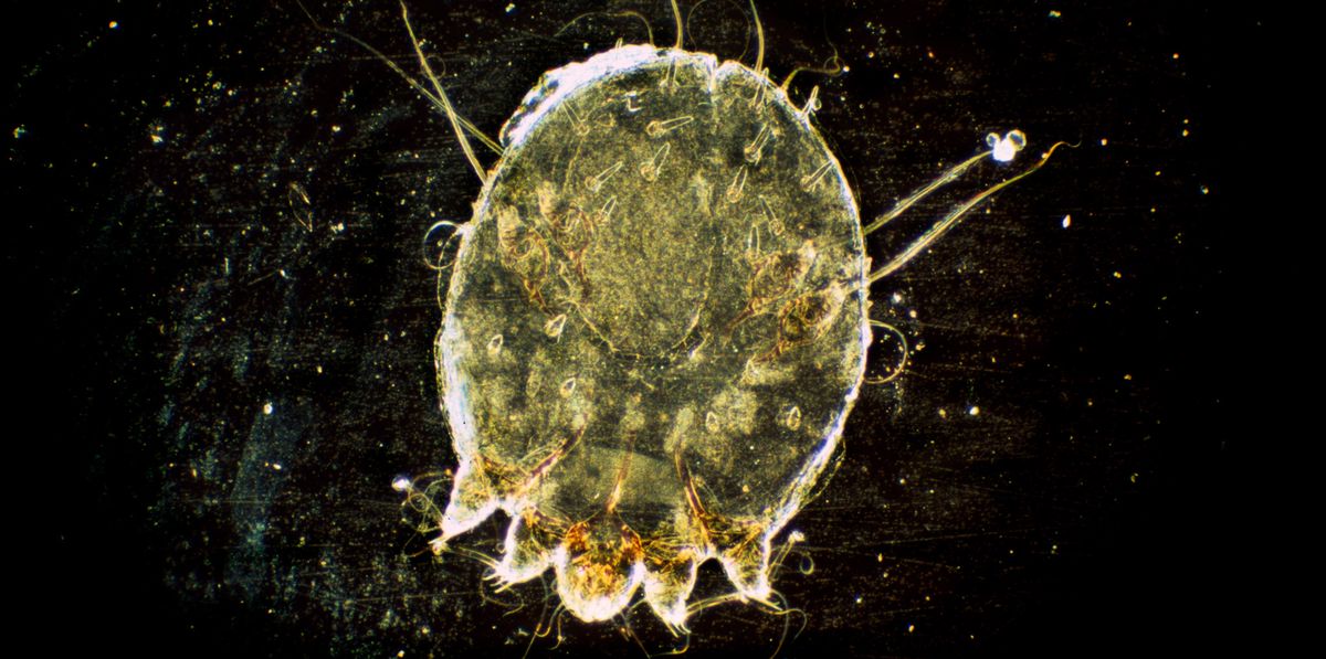 Mikrofotografie einer Krätze-Milbe. Der Parasit lebt in und auf der menschlichen Haut.