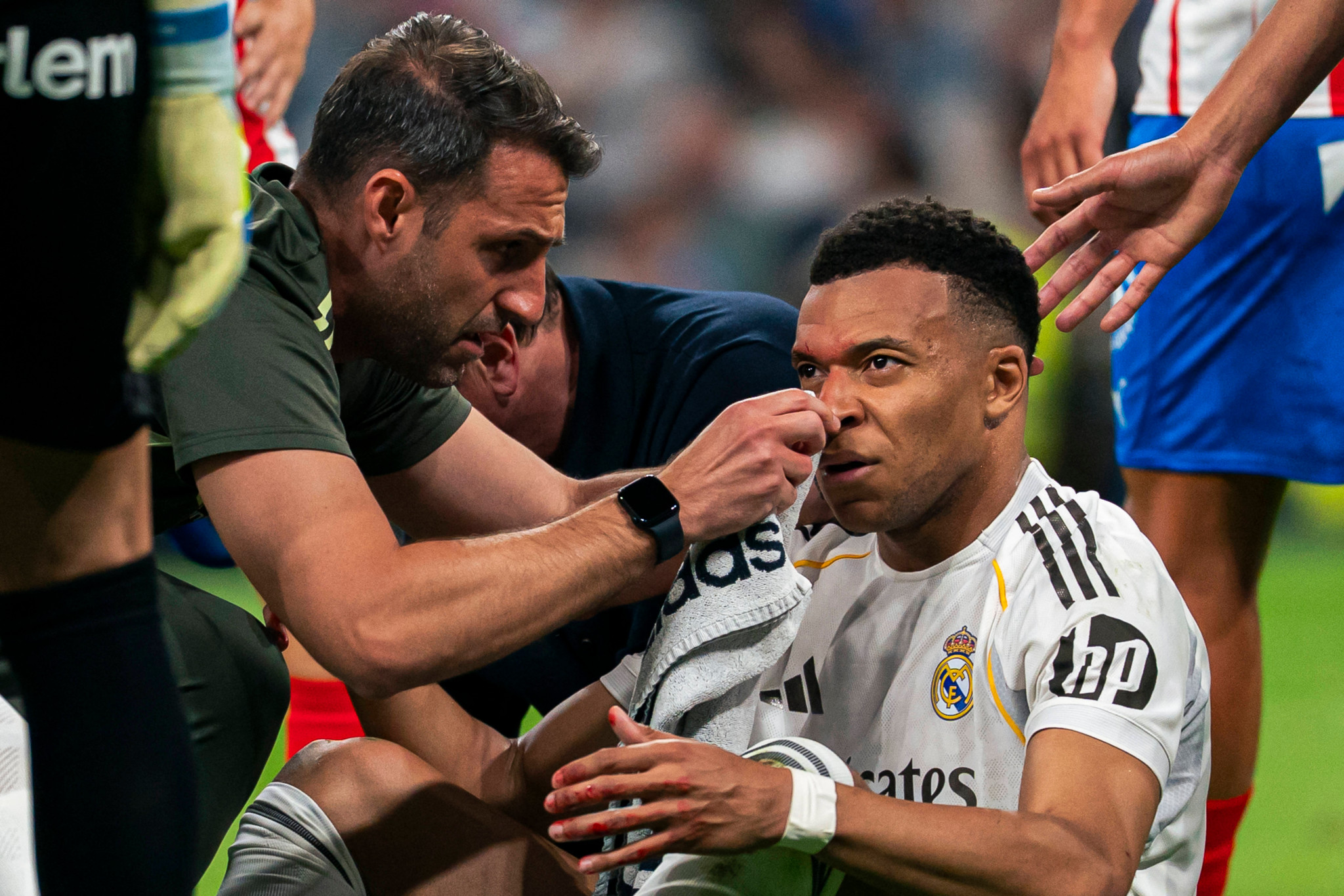 Champions League: Mbappé nach Kopfwunde im Real-Kader fürs Rückspiel gegen Bayern