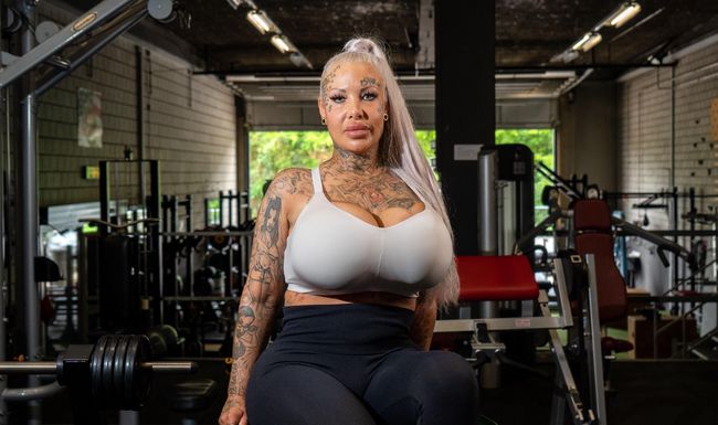 «Ich bin süchtig nach Schönheits-OPs»