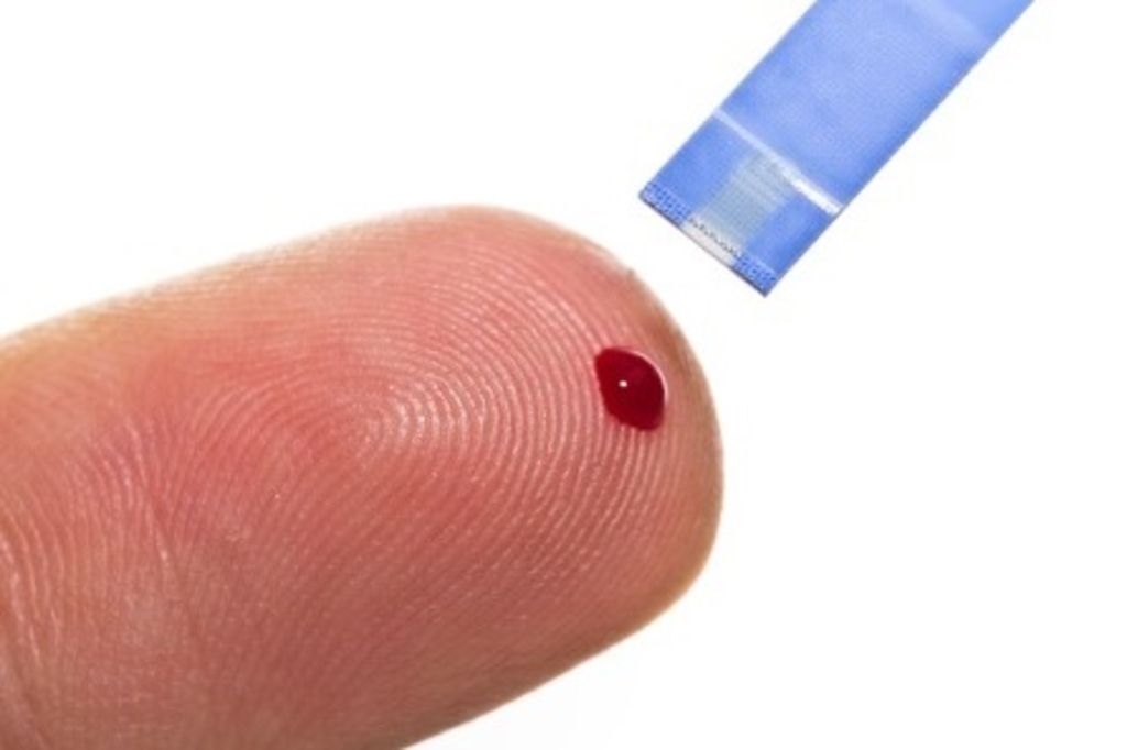 Des tests de dépistage du VIH vendus en pharmacie