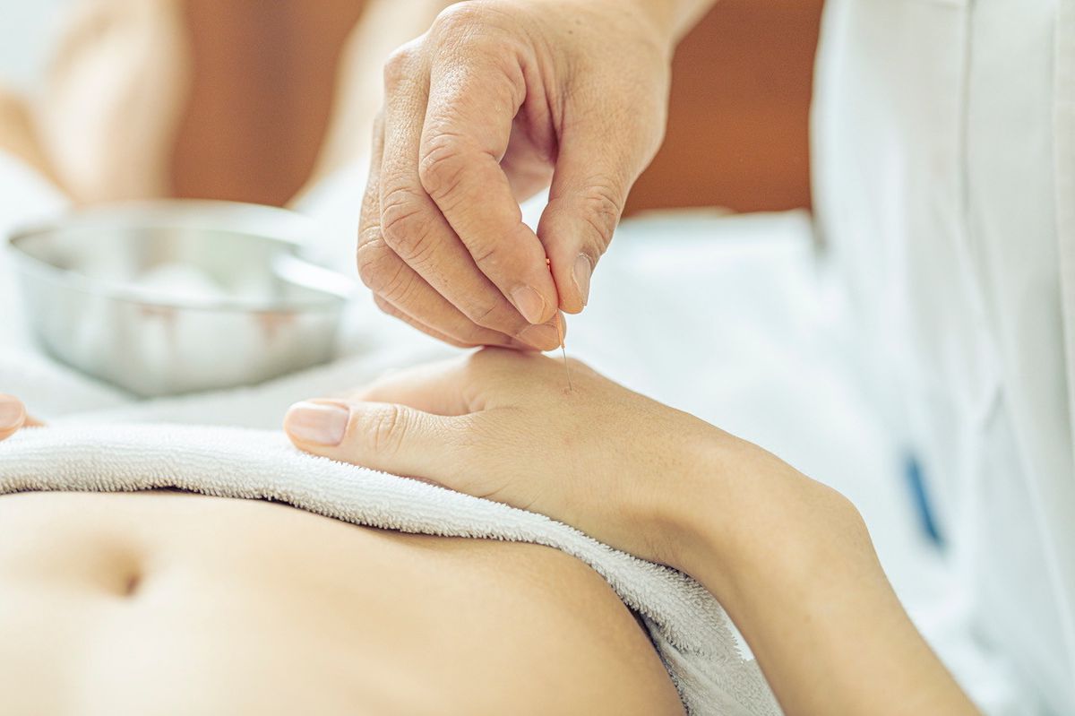 L’acupuncture pour traiter l’obésité.