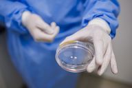 FuW-Einschätzung zu den Halbjahreszahlen: BioVersys rechnet mit Verzögerungen