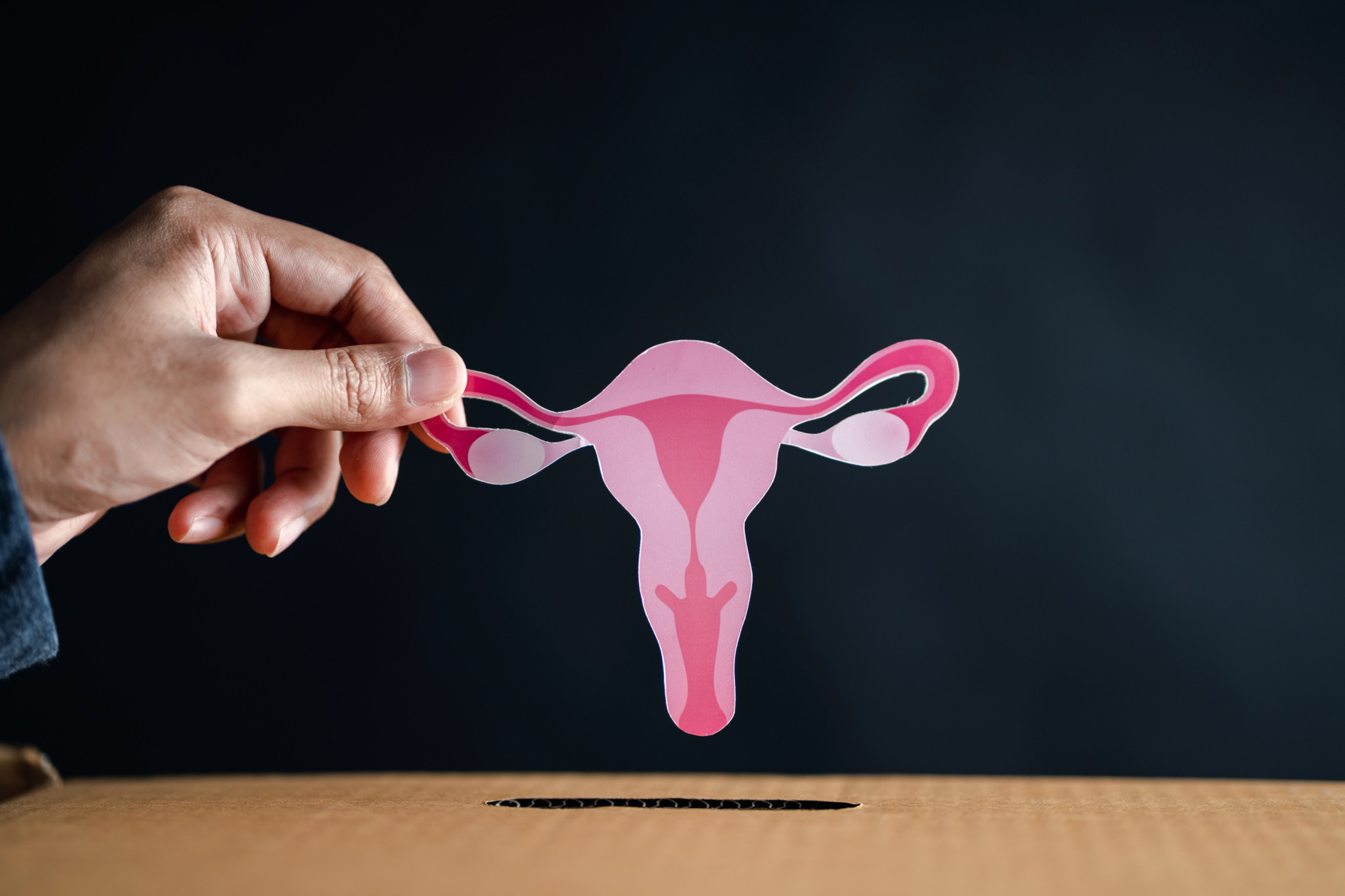 Häufige, aber unbekannte Hormonstörung: Polyzystisches Ovari
