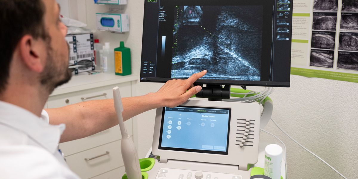 Cancer de la prostate: le dépistage rate sa cible en Suisse