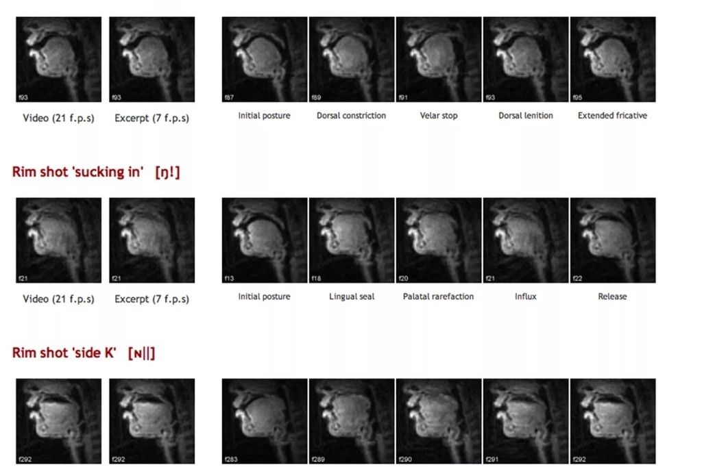 EtatsUnis Beatboxers sous IRM Tribune de Genève