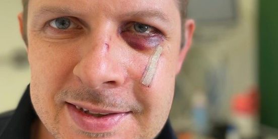 Verprügelter SPD-Mann Matthias Ecke zeigt sich auf Social-Media