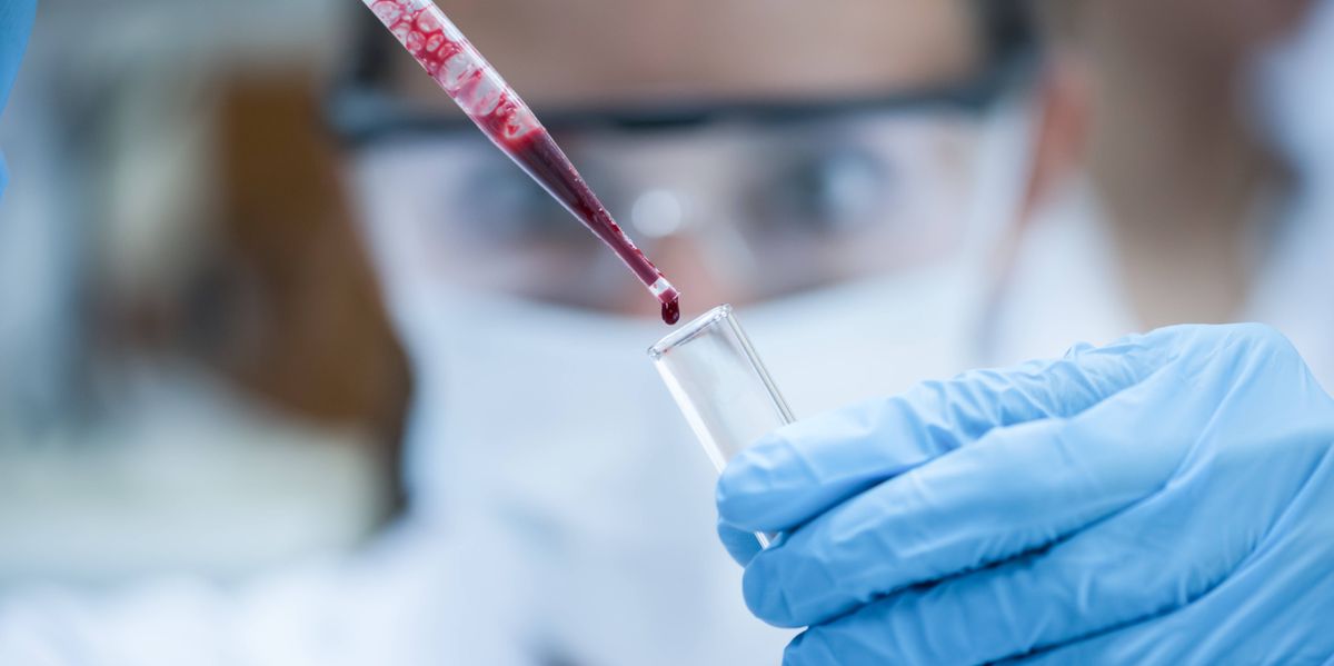 Proteine-im-Blut-Neuer-Bluttest-soll-Krebs-und-Demenz-deutlich-fr-her-erkennen-k-nnen