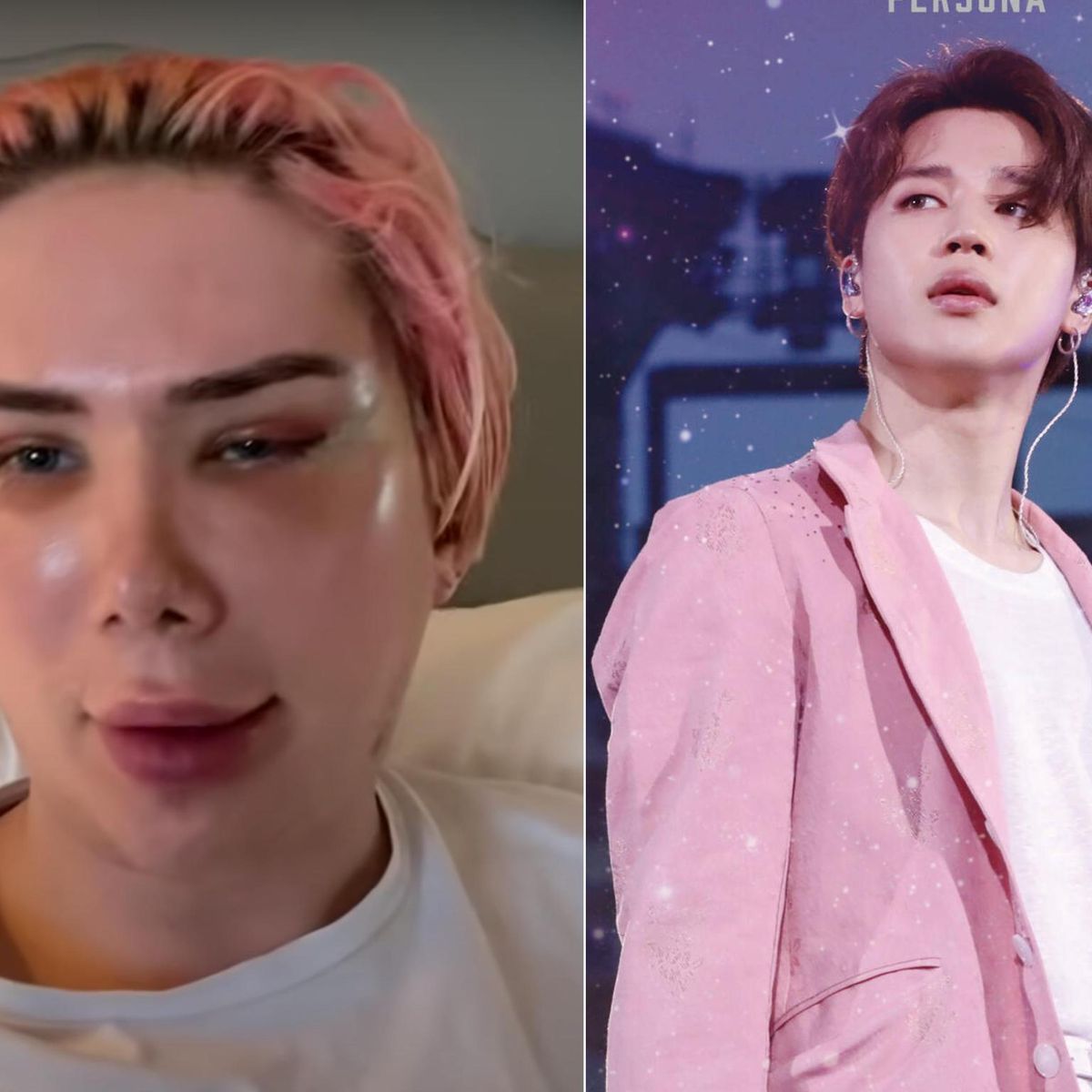 Est Ce Que Les Bts Ont Fait De La Chirurgie Royaume-Uni - Il subit 18 opérations pour ressembler à Jimin, de BTS - 20  minutes