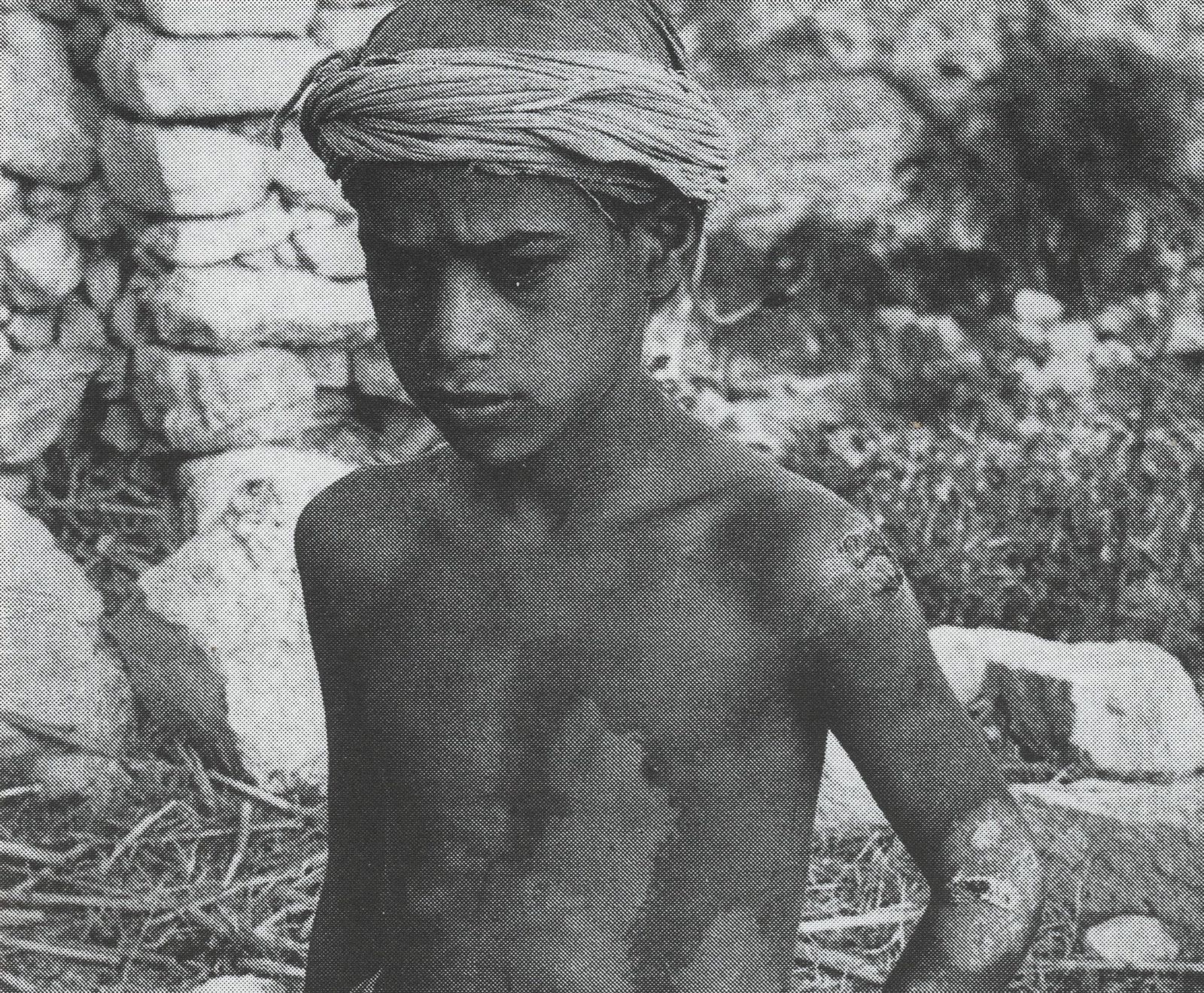 Selon un nouveau livre, cette victime 12 ans a été brûlée au Yémen par une variante du napalm, développée dans les usines Emser.