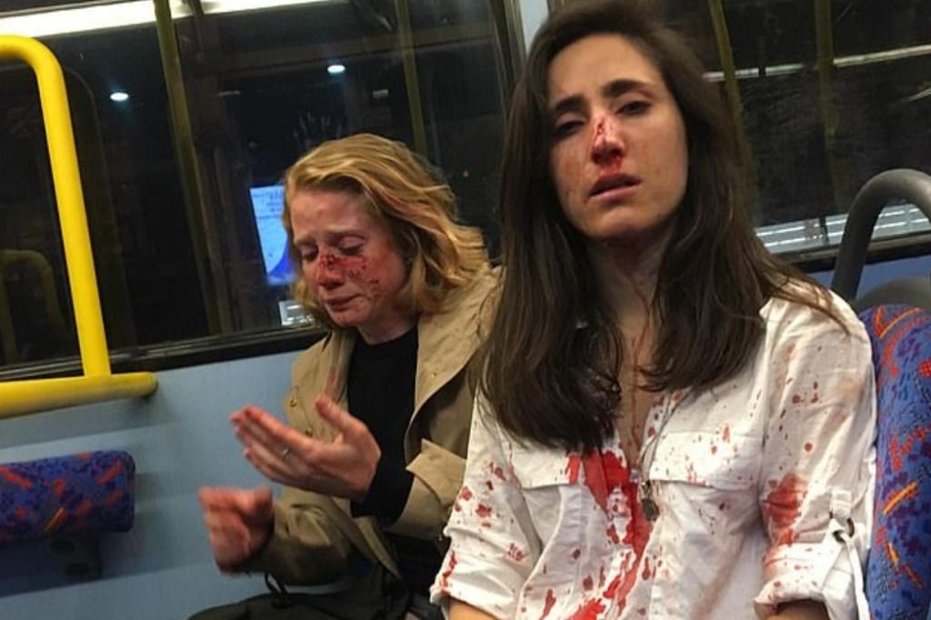 Violente agression d'un couple lesbien dans un bus