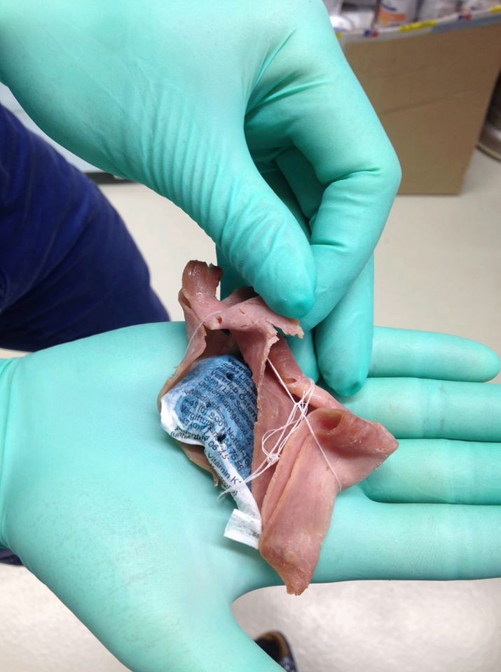 Eine Hand in einem grünen Latexhandschuh hält ein Stück Fleisch, das einen blauen Fremdkörper mit weissem Faden umschliesst.