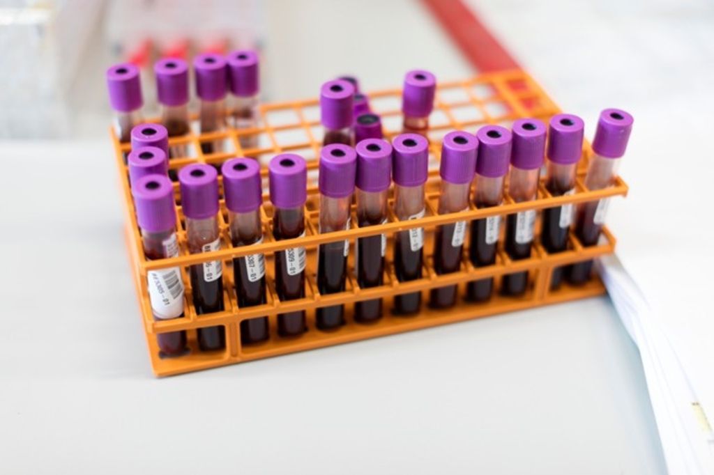 Turkménistan Obligés de faire le test VIH avant de se marier